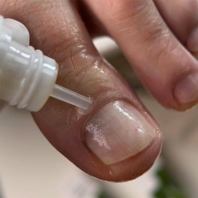 Регенеруюча олія Resultum проти оніхолізису та грибка, 8 мл в інтернет магазині Beauty Hunter