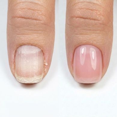 Лак Resultum Nail Polish Hardener S.O.S + Shea Butter, розовый, 11 мл в интернет магазине Beauty Hunter
