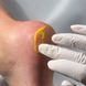 Регенерирующий крем от трещин Nails Of The Day, с облепихой и лемонграсом, 25 мл 6 из 6